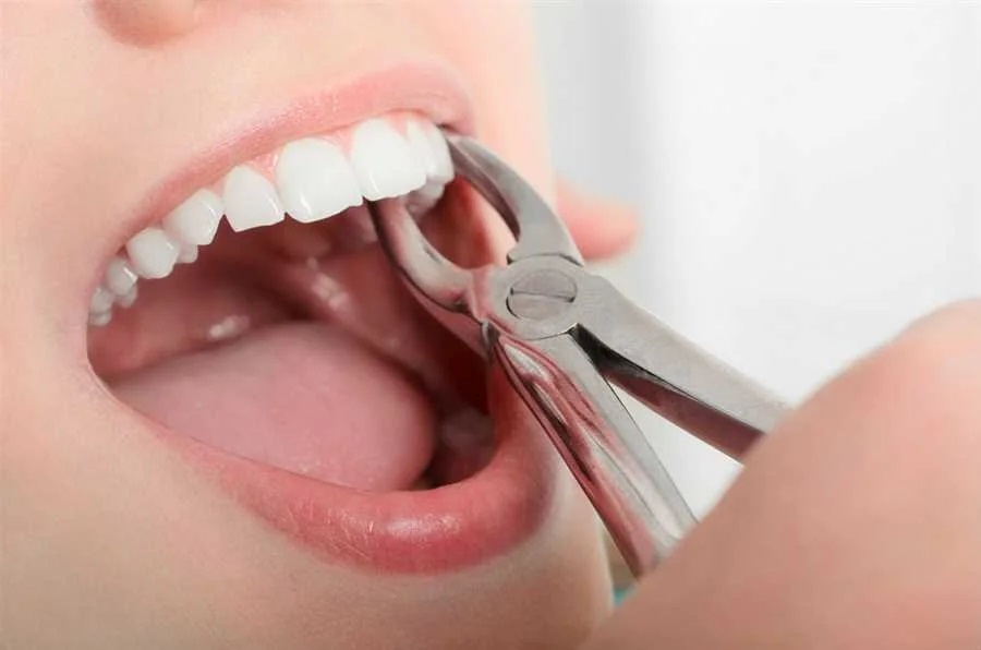 RV Dentistree in Nallagandla